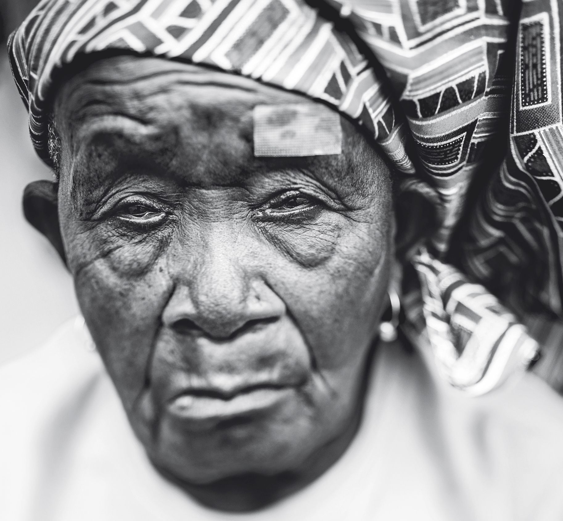 Portrait d'une femme avant son opération de la cataracte