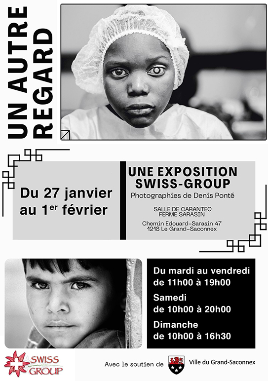 Exposition Cataracte